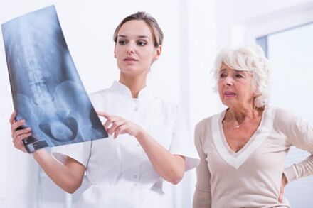 El médico le muestra al paciente una imagen de rayos x de la columna vertebral
