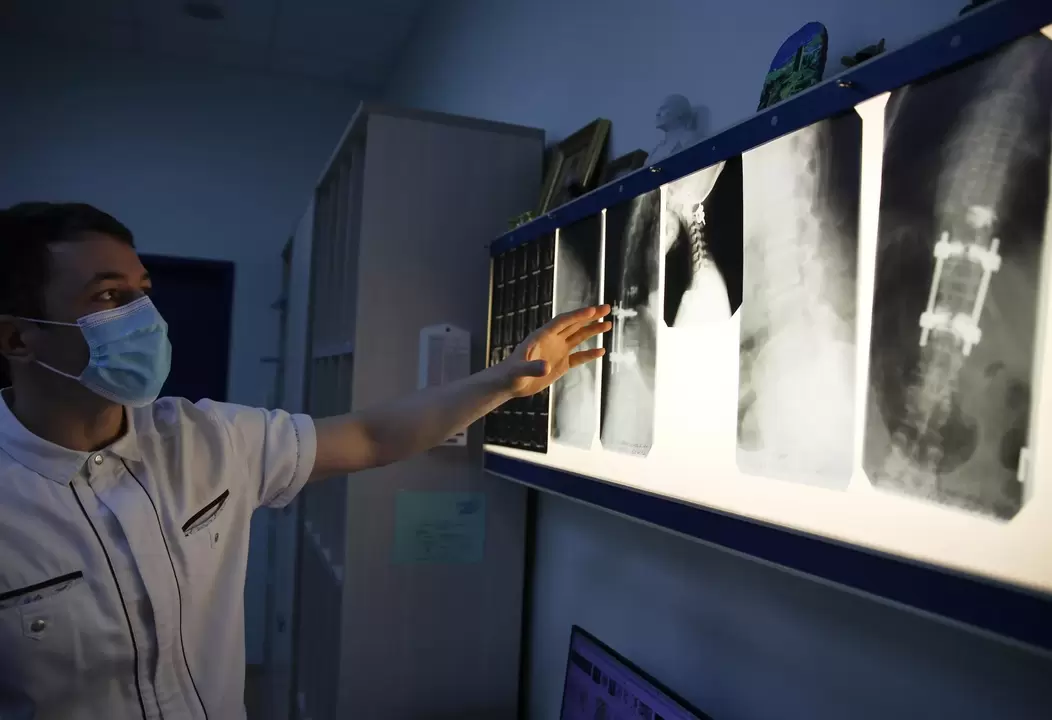 Los médicos diagnostican la osteocondrosis cervical mediante métodos instrumentales, como la radiografía. 